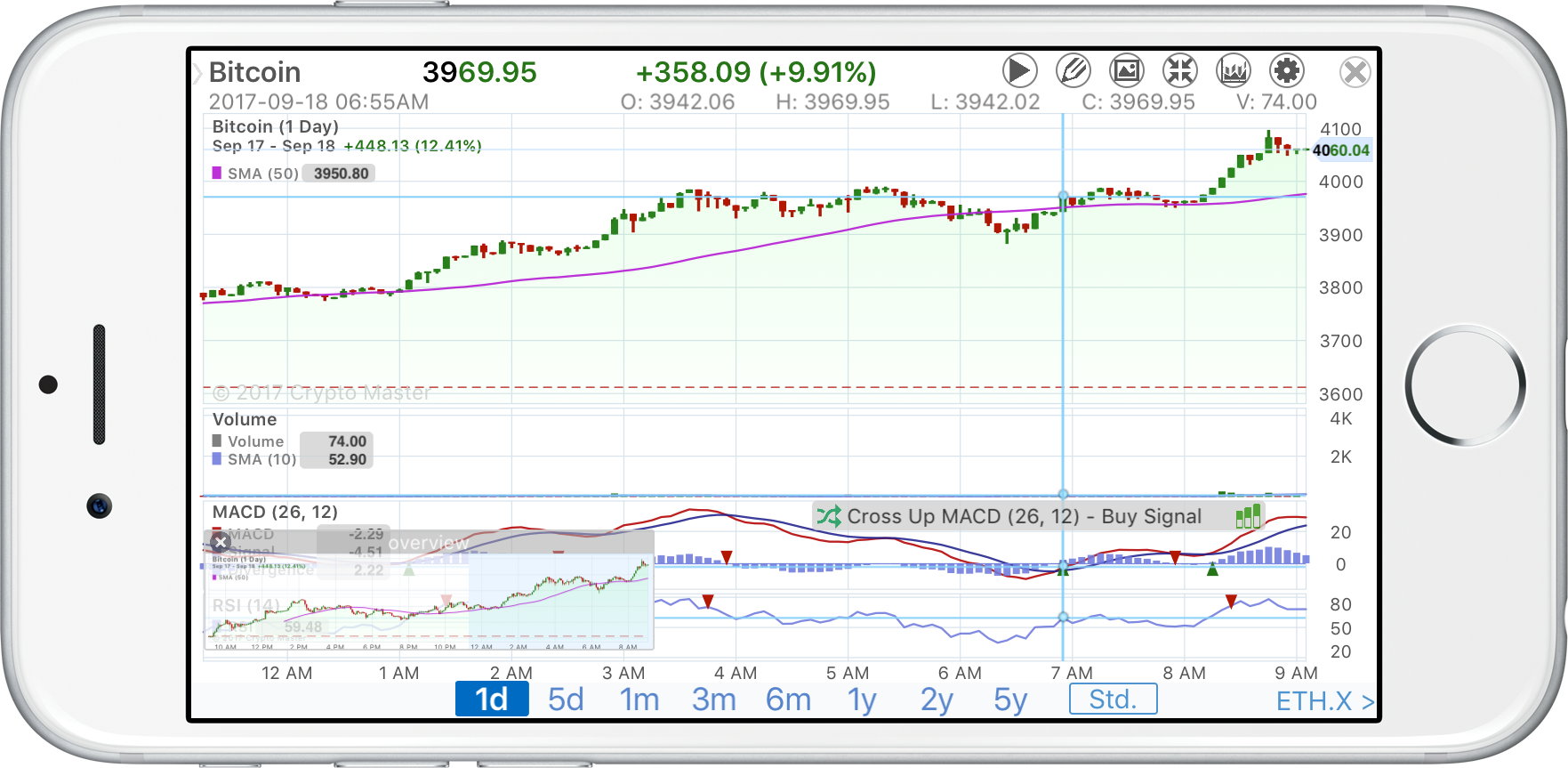 Candlestick Chart Ios